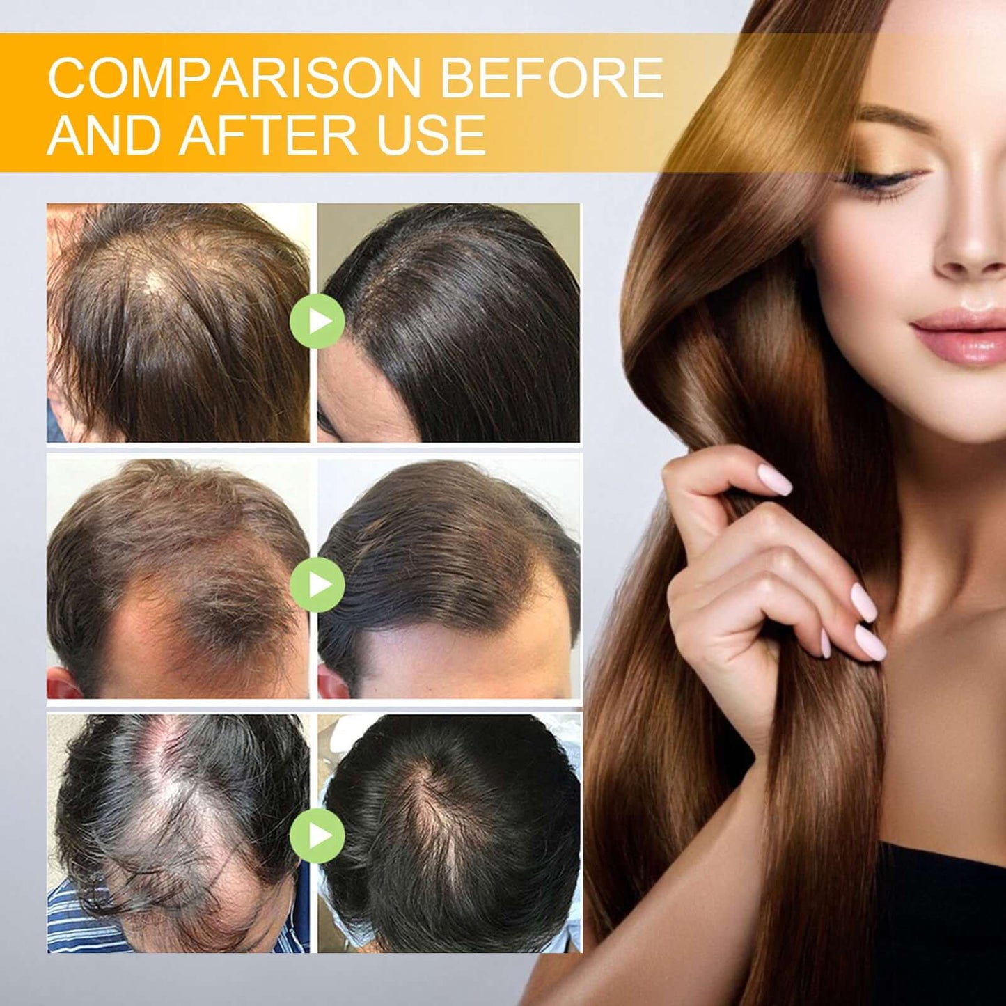 Best Biotin Anti-Hairloss Treatment Spray