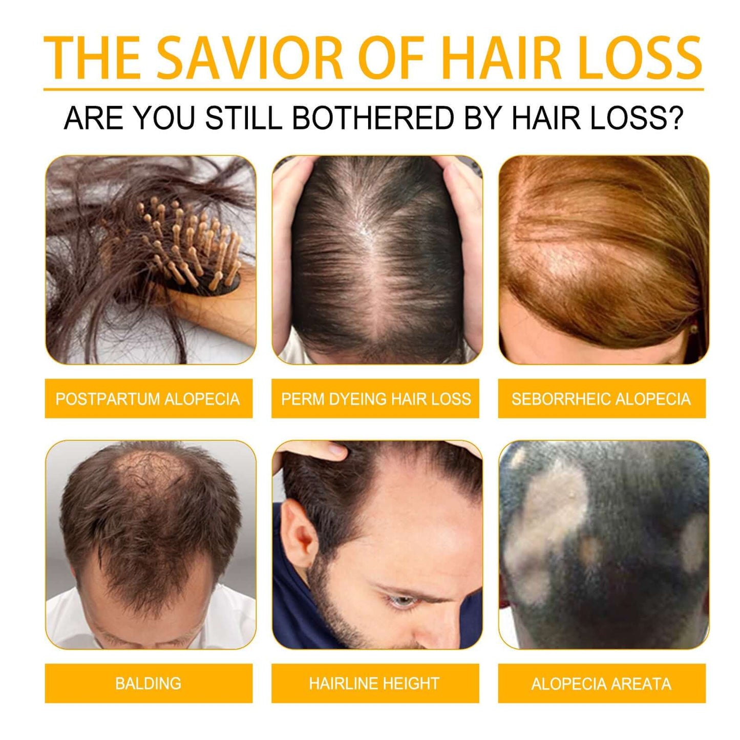 Best Biotin Anti-Hairloss Treatment Spray
