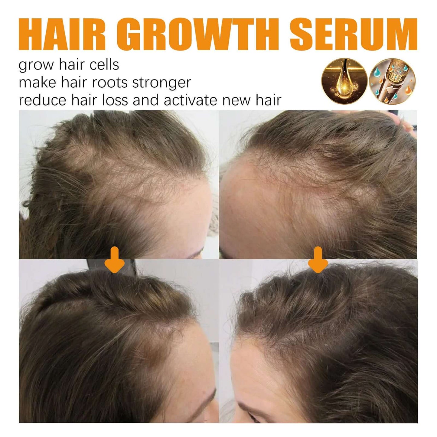 Best Biotin Anti-Hairloss Treatment Spray