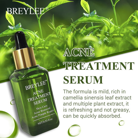 Hydrating acne treatment serum for clear skin