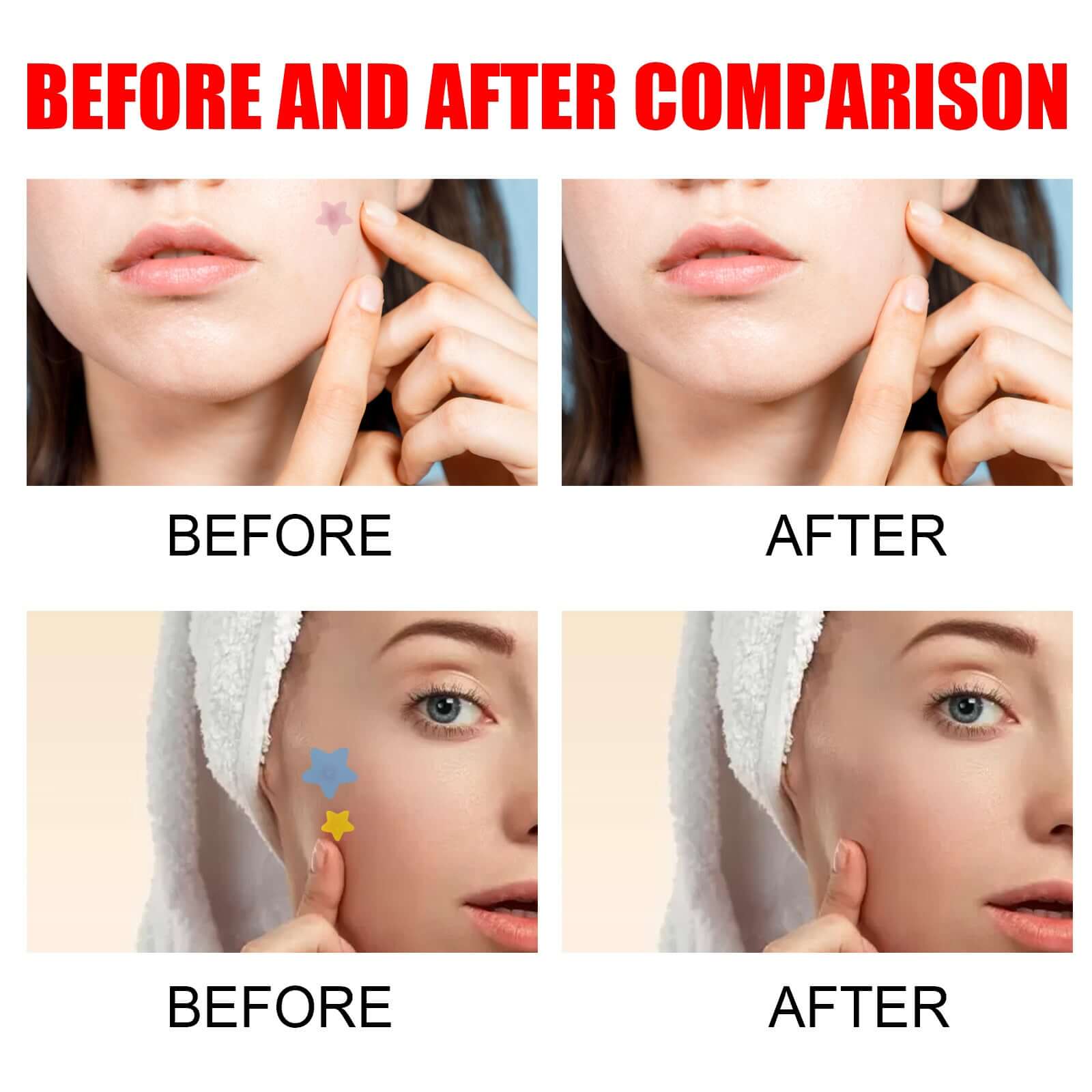 Hydrocolloid Pimple Patches Star-shaped cute and Effective
