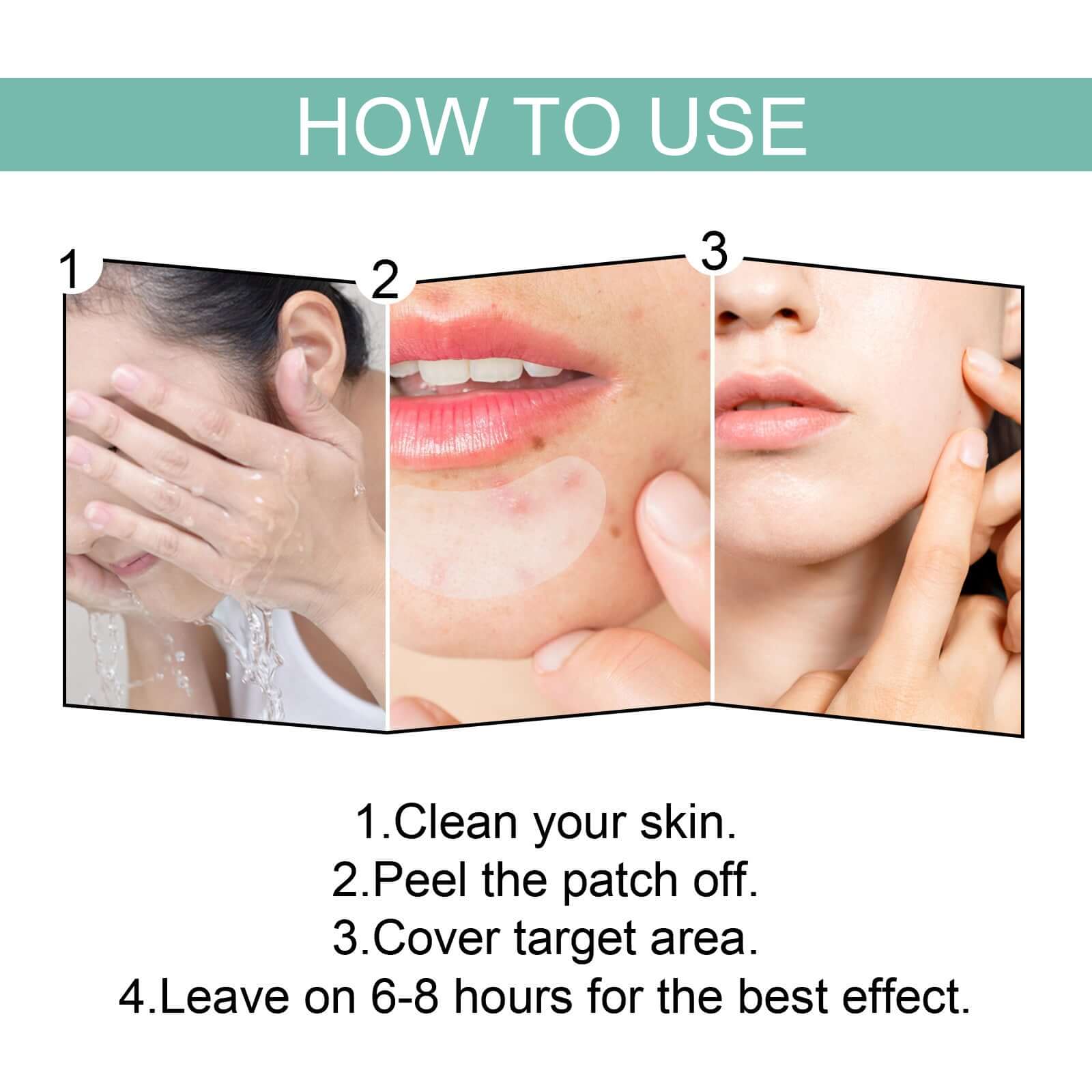Acne Patches to reduce acne Marks and heal acne
